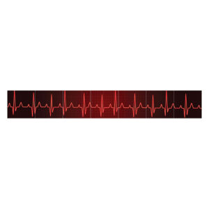 Heartbeat Collection - Back Prop