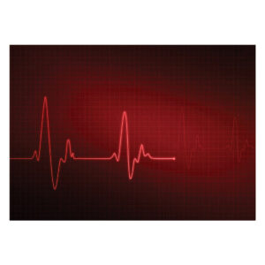 Heartbeat Collection - Floor